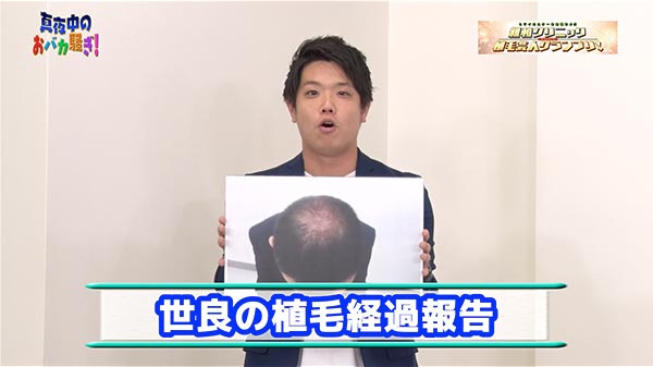 千葉テレビ　植毛芸人グランプリ_20201105_2