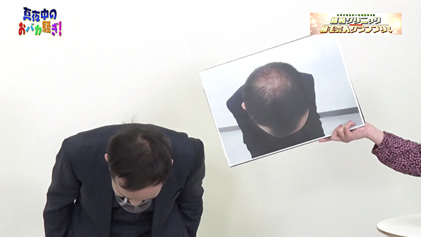 千葉テレビ　植毛芸人グランプリ_20210204_2