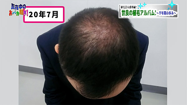 千葉テレビ　植毛芸人グランプリ_20210304_2