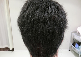 NC-MIRAI法の仕上がり