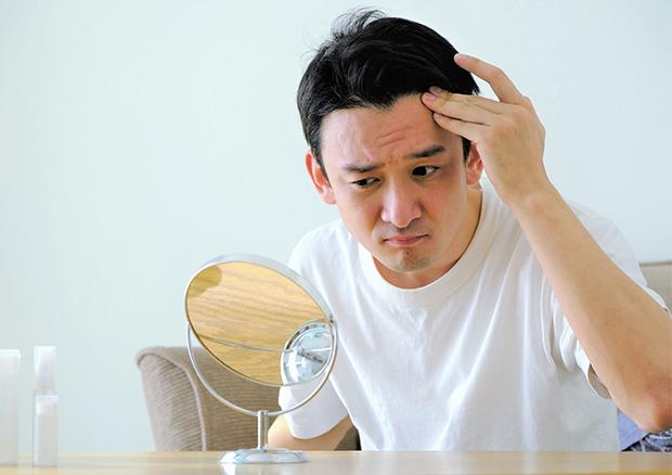 AGAは自然に治る？途中で止まる？