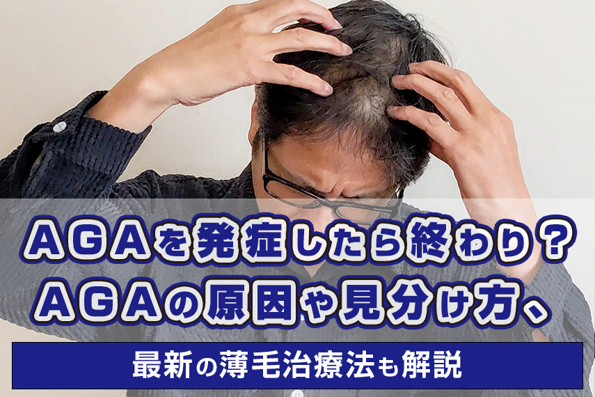 AGAを発症したら終わり？AGAの原因や見分け方、最新の薄毛治療法も解説