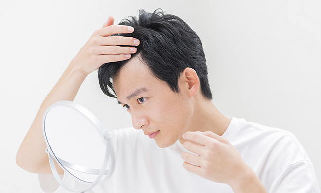 20代でも若ハゲに？その原因とは