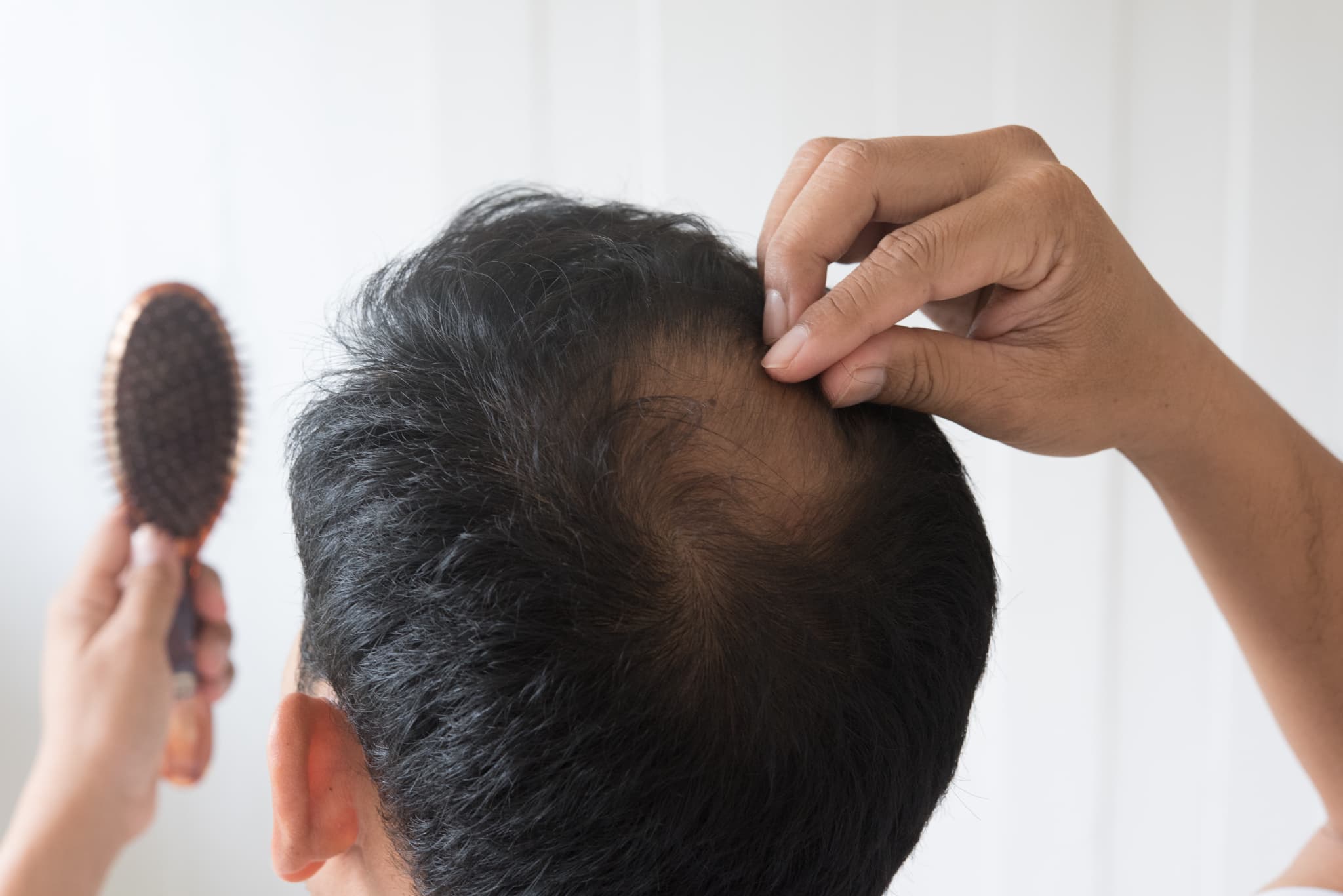 頭頂部の薄毛部分を指で確認している男性の後ろ姿