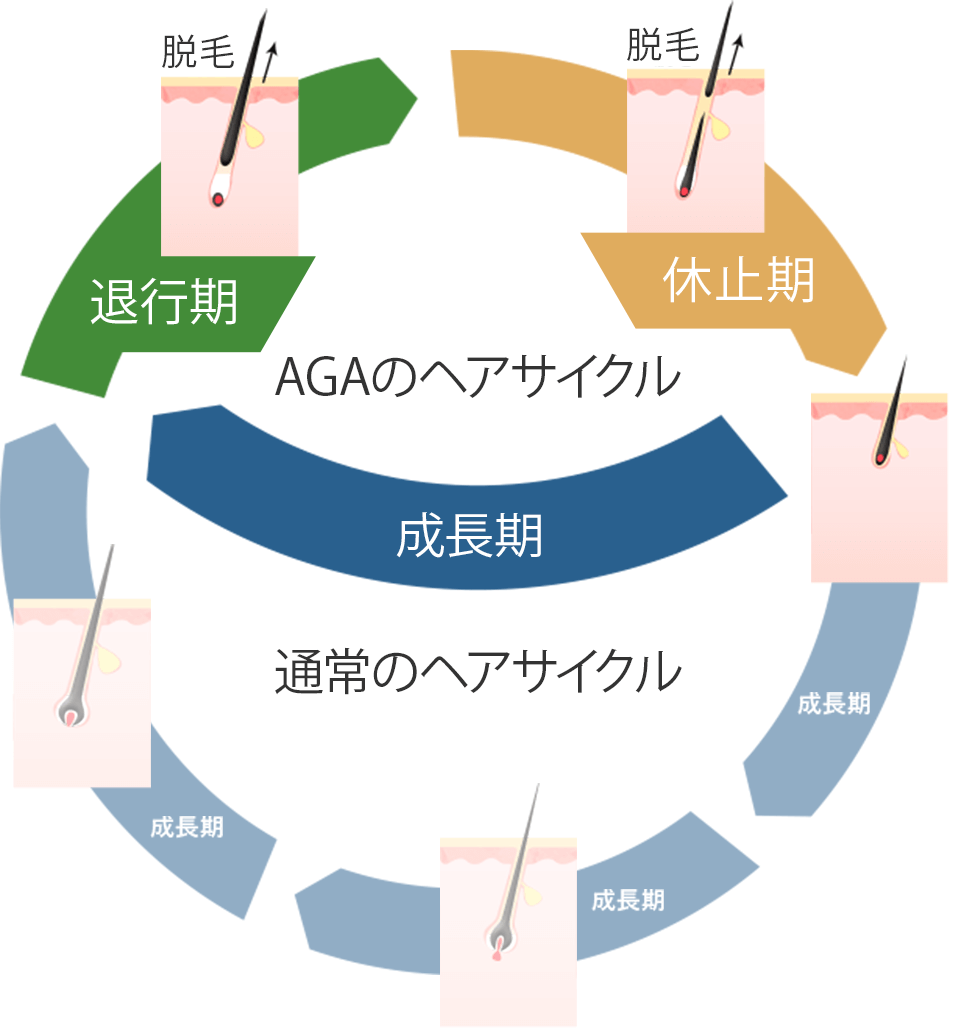 AGA