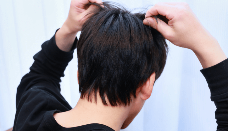 薄毛の原因と対策