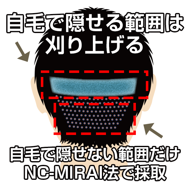 United MIRAI法
