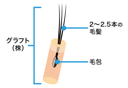 グラフト（株）を説明するイラスト。グラフト（株）は移植する毛包を数える単位のことを指し、一つの毛包からは2～2.5本の毛髪が生えます。