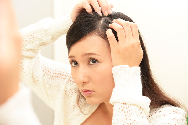 女性の側頭部の薄毛の特徴