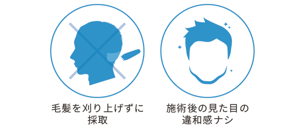 NC-MIRAI法の特長_アイコン