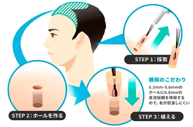 高密度かつ自然な仕上がりを目指せる
