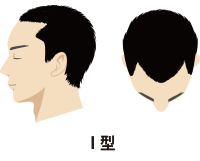 Ⅰ型