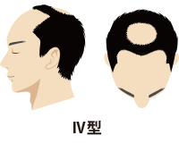 Ⅳ型