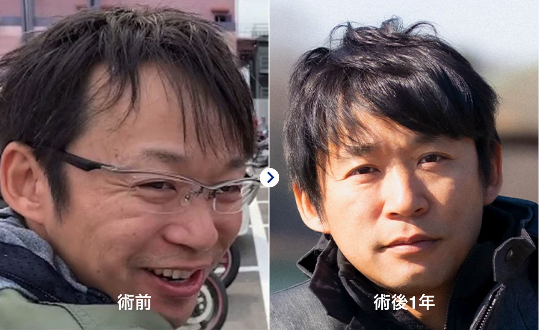 症例紹介