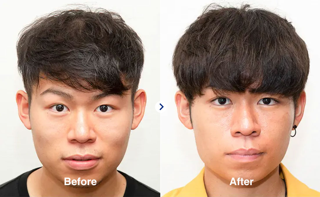 症例紹介