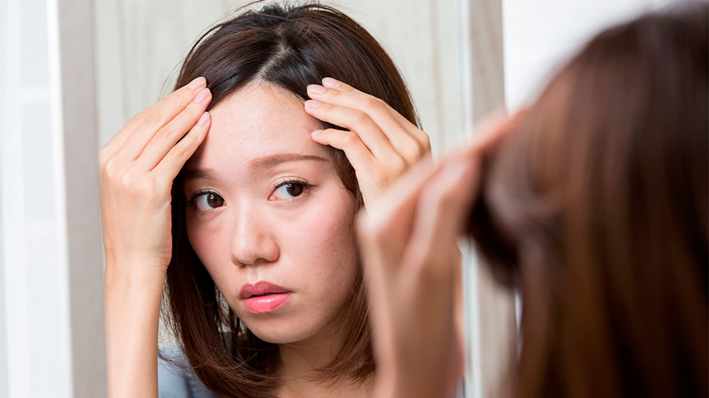 植毛で、女性らしい丸みを帯びた生え際ラインを形成