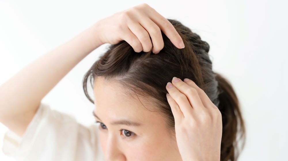 女性のおでこや生え際に植毛するメリット