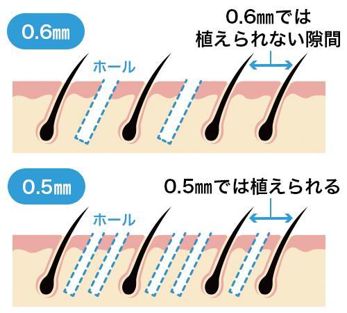 「MIRAI法」の特徴とは