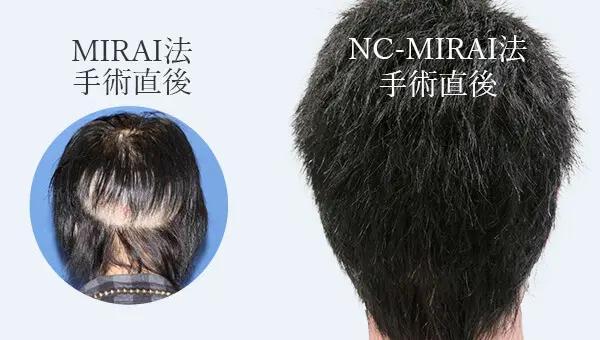 NC-MIRAI法
