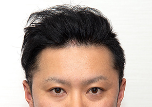 30代T.Mさん 1年後
