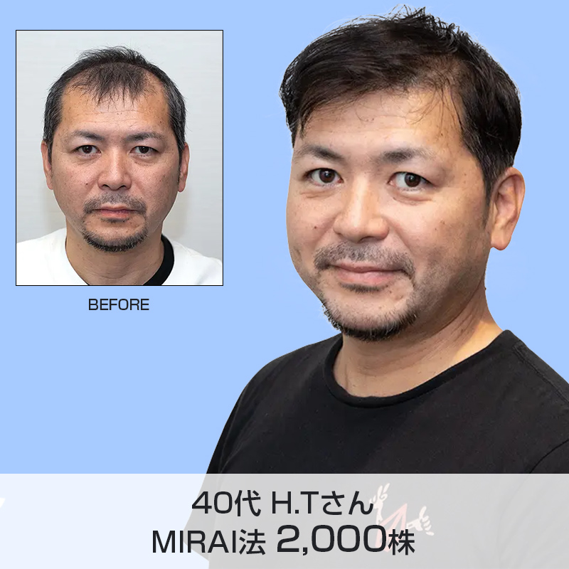 40代H.TさんMIRAI法2,000株