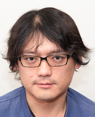 40代 男性 I.Mさんの顔写真（施術前）