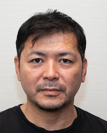 40代 男性 H.Tさんの顔写真（術後1年）