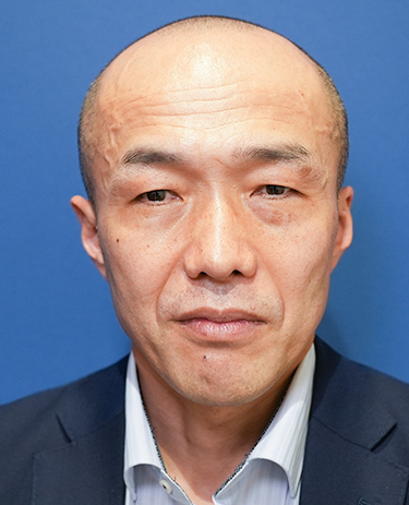 50代男性Y.Tさんの顔写真（施術前）