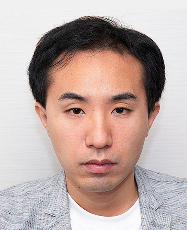 30代 男性 K.Hさんの顔写真（施術前）