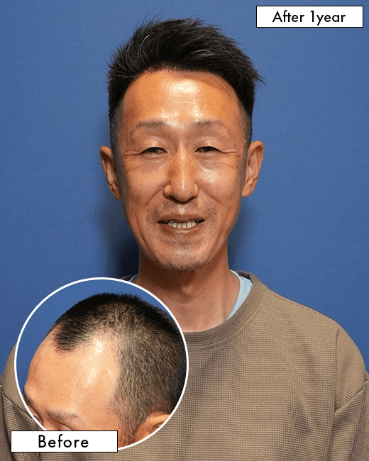 Y.Jさんの上半身写真（施術後）