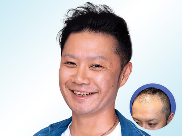 30代男性T.Mさんの上半身写真（施術後）＋施術前写真