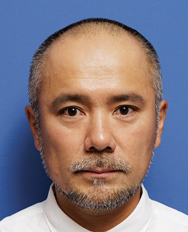 男性 中村 彰宏さんの顔写真（施術前）