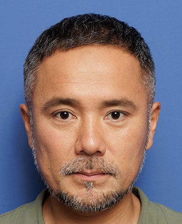 男性 中村 彰宏さんの顔写真（術後6か月）