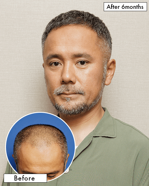中村 彰宏さんの上半身写真（術後10日目）