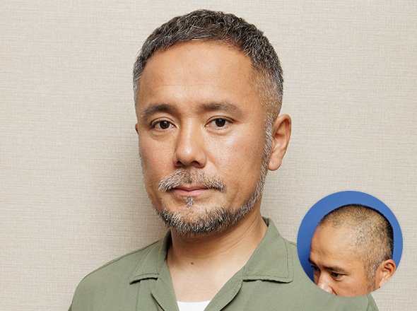30代男性 中村 彰宏の上半身写真（施術後）＋施術前写真