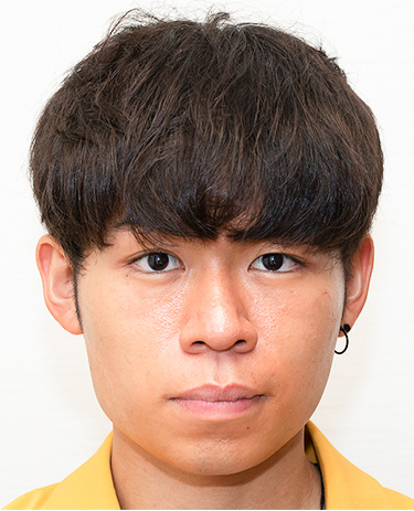 20代 男性 K.Kさんの顔写真（術後1年）