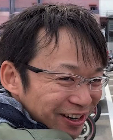 ホワイトベース二宮祥平さんの顔写真（施術前）