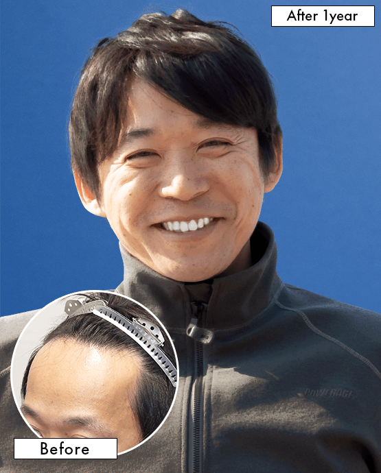 ホワイトベース二宮祥平さんの上半身写真（施術後）