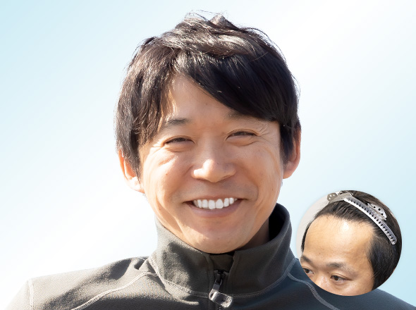 ホワイトベース二宮祥平さんの上半身写真（施術後）＋施術前写真
