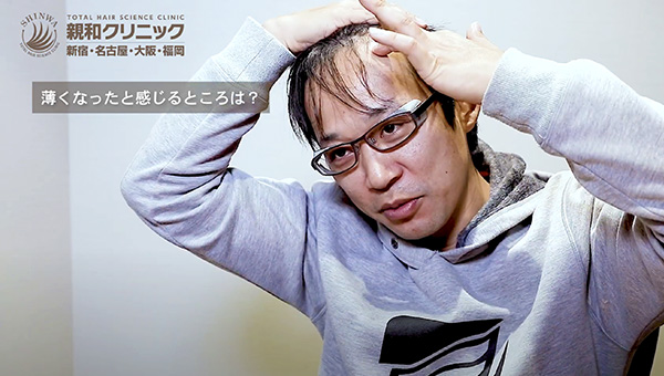 YouTuber二宮祥平さん 自毛植毛 体験記 手術偏_03