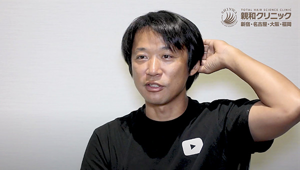 YouTuber二宮祥平さん 自毛植毛 体験記 6ヶ月偏_06