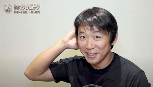 YouTuber二宮祥平さん 自毛植毛 体験記 7ヶ月偏_04