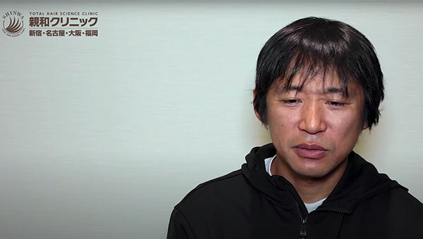 ouTuber二宮祥平さん 自毛植毛 体験記 7ヶ月偏_05