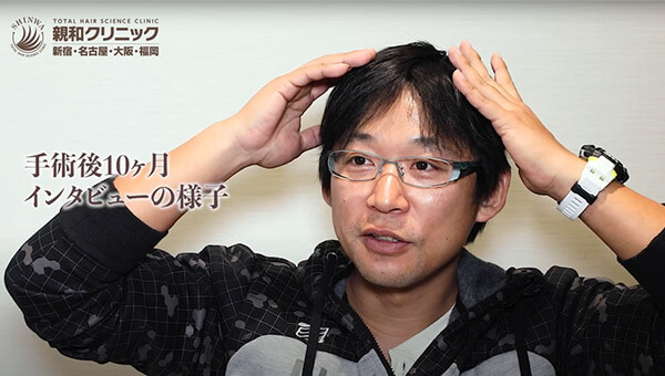 YouTuber二宮祥平さん 自毛植毛 体験記 10ヶ月偏_04