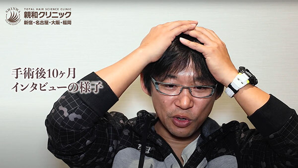YouTuber二宮祥平さん 自毛植毛 体験記 10ヶ月偏_05