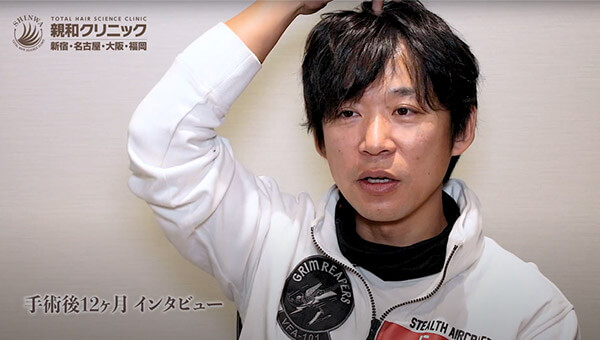 YouTuber二宮祥平さん 自毛植毛 体験記 12ヶ月偏_05