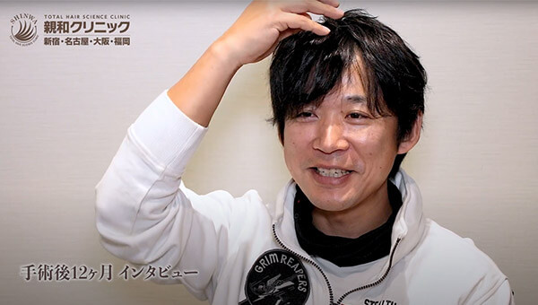 YouTuber二宮祥平さん 自毛植毛 体験記 12ヶ月偏_07