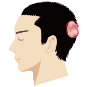 後頭部が薄毛の男性頭部のイラスト