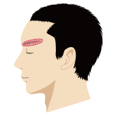 眉毛が薄毛の男性頭部のイラスト