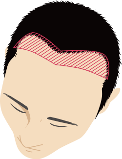 生え際のイメージ